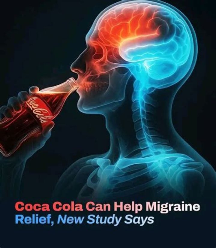 Coke Migraine Relief