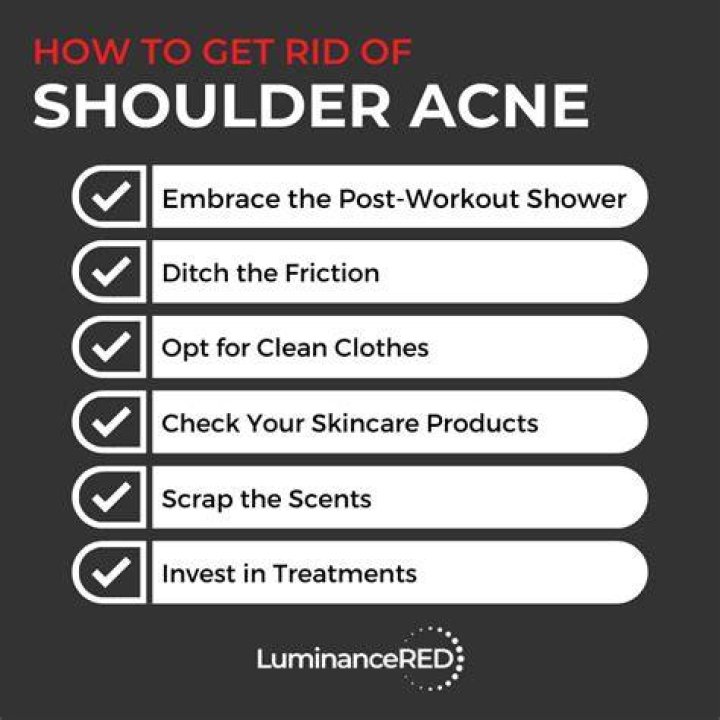 Shoulder acne - How To Discuss